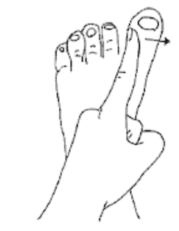 Autorééducation du gros orteil dans les suites d'un turf toe : étirement latéral