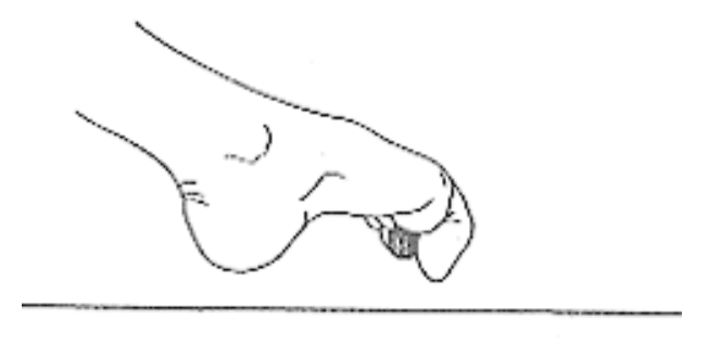 Autorééducation du gros orteil dans les suites d'un turf toe : attraper une bille