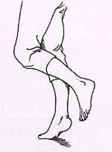 Protocole de Stanish : exercice en appui sur une pointe de pied