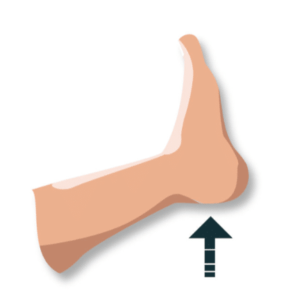 Etape 4 : élever la jambe touchée