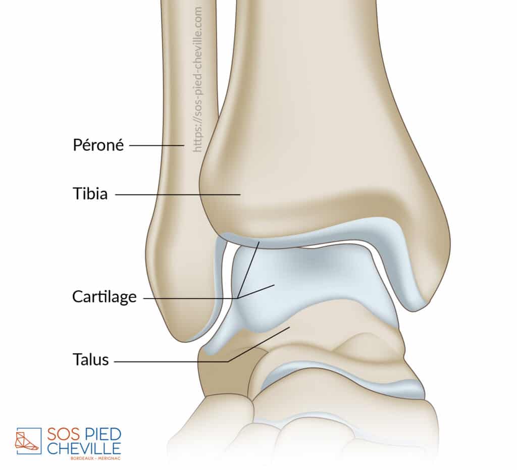 Schéma de la cheville de face : le péroné, le tibia, le talus et le cartilage qui recouvre les surfaces articulaires