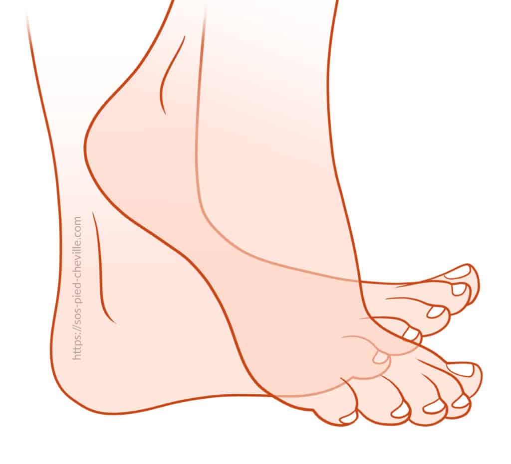 Schéma de flexion dorsale : le pied est relevé, orteils vers le haut, exercice d’auto-rééducation après une ligamentoplastie